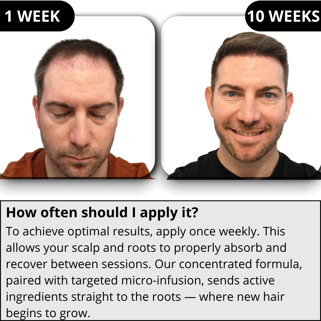 RITUEL™ Hair Regrowth