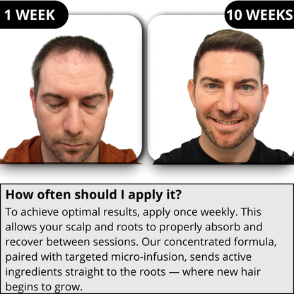 RITUEL™ Hair Regrowth